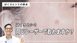 ほくろとシミの違いって何?治療法など比較解説!