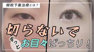 二重治療の切らない眼瞼下垂って何?