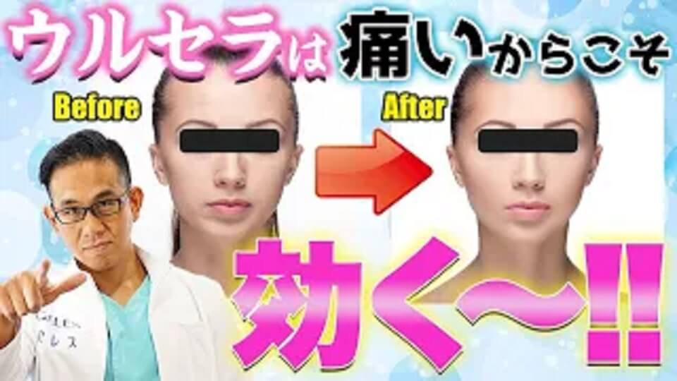 最強ハイフ「ウルセラ」の動画解説
