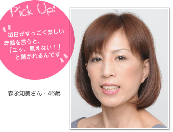 フェイスリフト患者様のインタビュー
