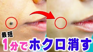 37971ほくろ除去で後悔しないための完全ガイド|医師が解説する5つのポイント