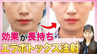 エラボトックス治療は小顔に効果バツグン!