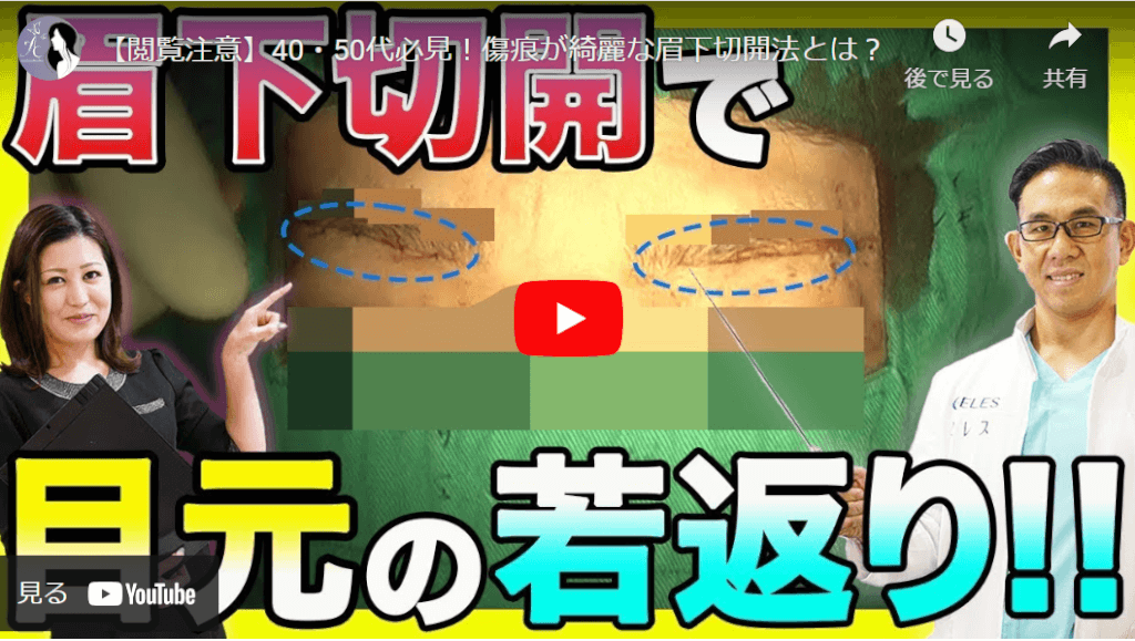 眉下切開の手術動画