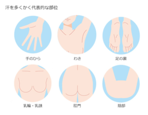 汗をかく部位