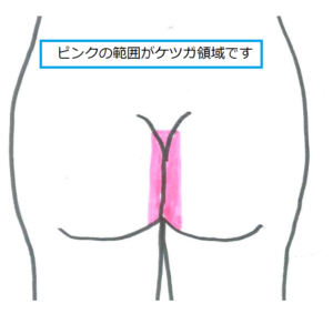 ケツガ範囲