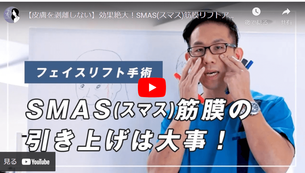 SMAS引き上げのフェイスリフト