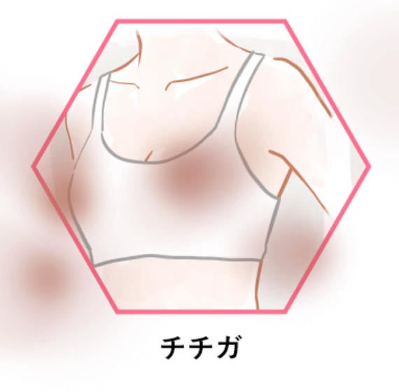 乳輪からの独特な臭い、それはチチガの可能性が…