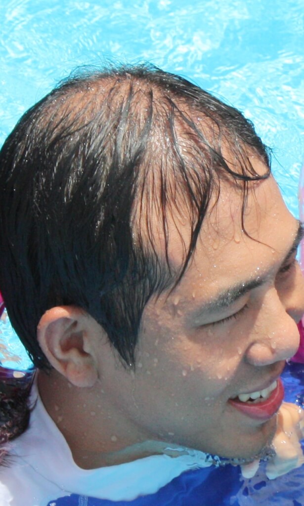 薄毛に気づいたときのショックは大！でもそれが出発点【女性薄毛解決ブログ第5回】