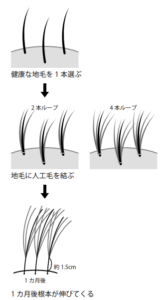 結着増毛イラスト