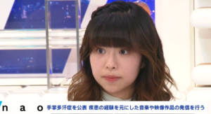 手掌多汗症のnaoさん
