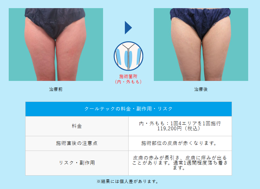 クルスカの効果