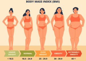 BMI30以上の場合
