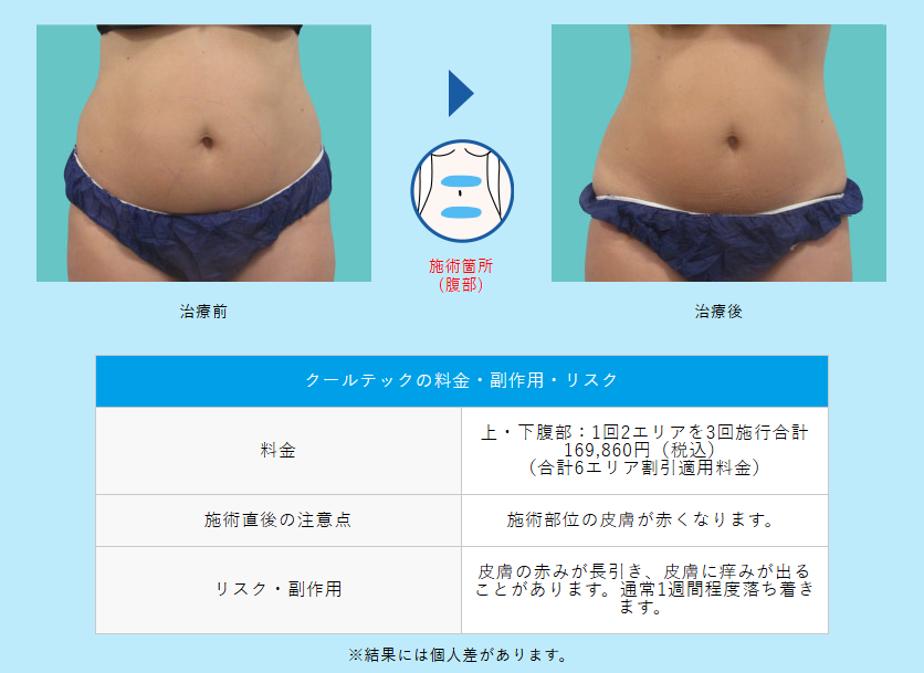 クルスカの効果