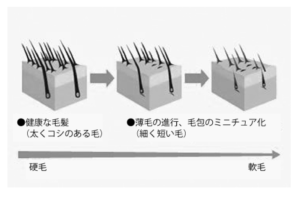 毛周期のミニチュア化