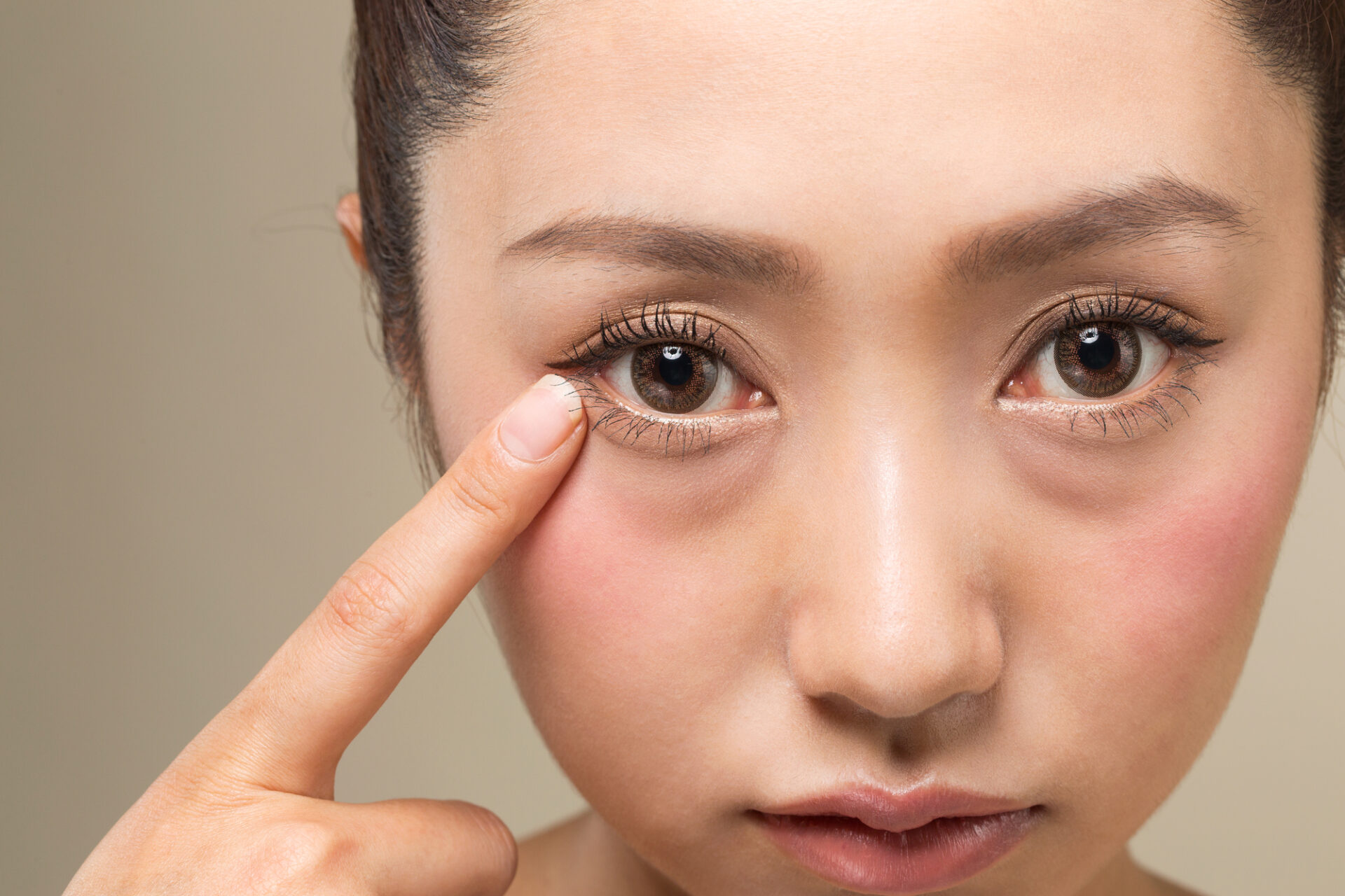 埋没法の腫れのピークはいつ？術後の経過と対処法を徹底解説