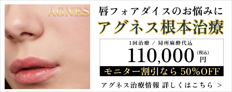 フォアダイスのアグネス治療の相談はこちら　