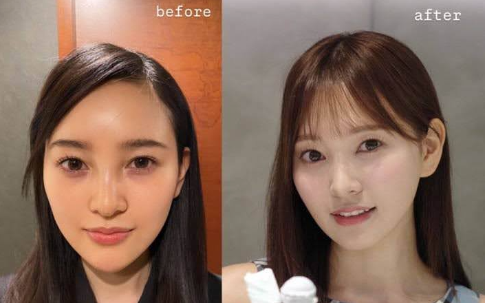 兒玉遥さんの美容整形を専門医が解説