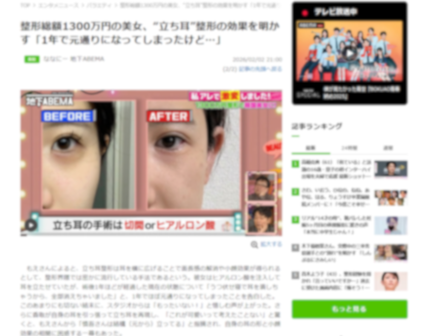 韓国女優風整形1300万円美女の立ち耳が1年で戻った話