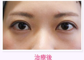 治療後