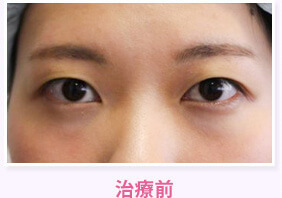治療前