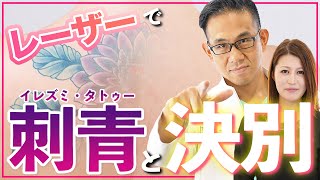刺青・タトゥーはレーザーで簡単除去できる！