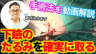 下まぶたのたるみ取りを手術動画を見ながら医師が解説