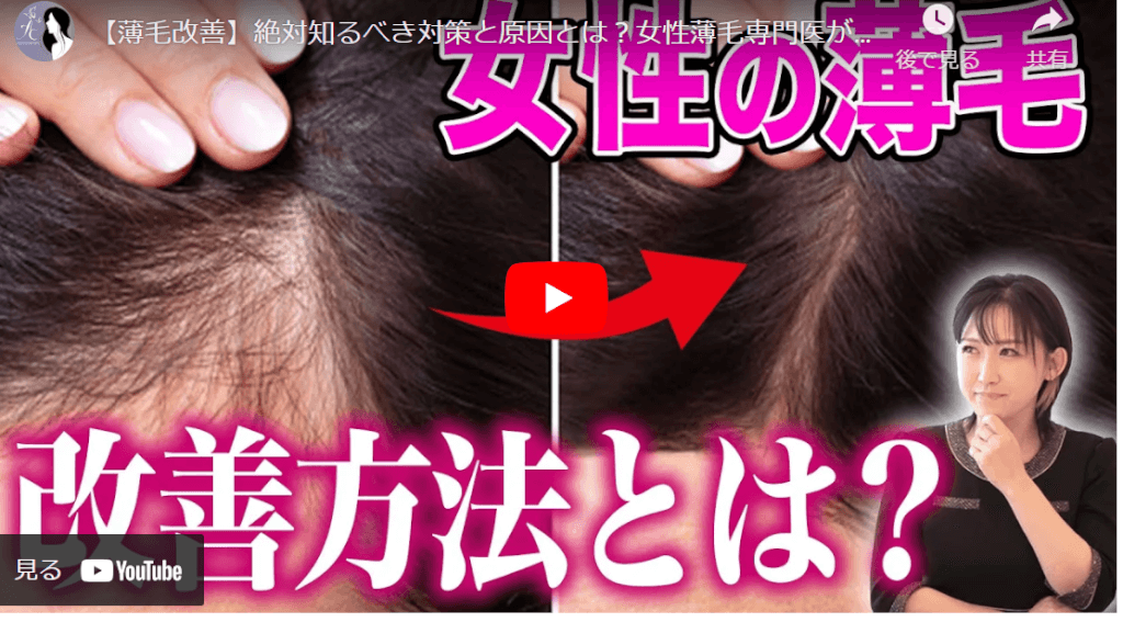 女性薄毛の動画解説