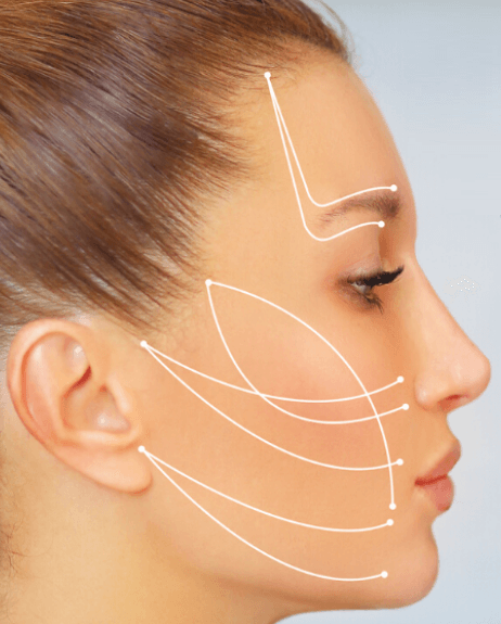 Understanding the Effectiveness of Z Lift and Collagen Lift: A Journey Through Absorbable Thread Lifts