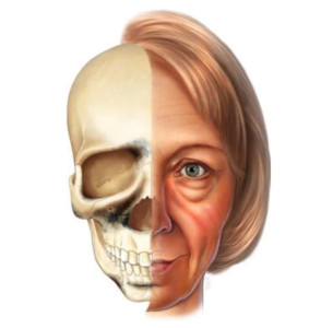 骨吸収の顔の部位とたるみの関係