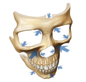 骨吸収の部位、顔のパーツ別