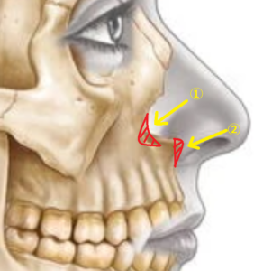 上顎骨の骨吸収の部位