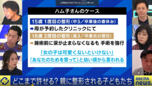 グラハム子の二重埋没法